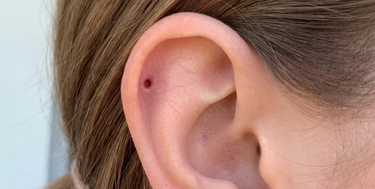 Signs of Piercing Infection vs. Normal Healing